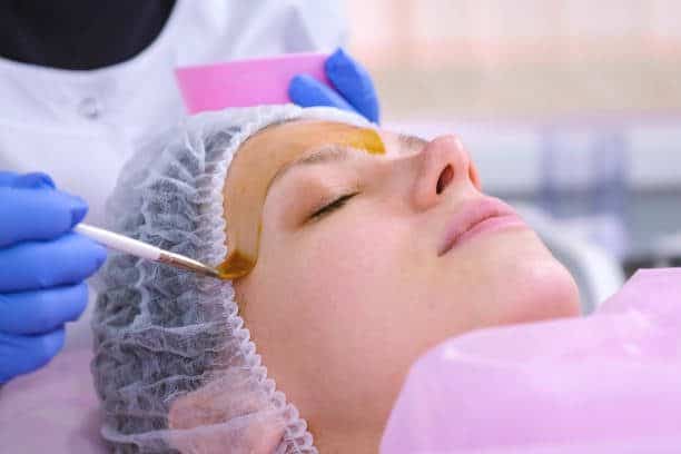 How long do Chemical Peels Last