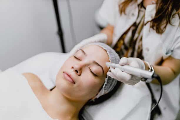 Microneedling for Scars - Does it Work?