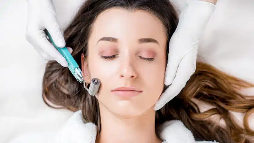 microneedling for scars before and after