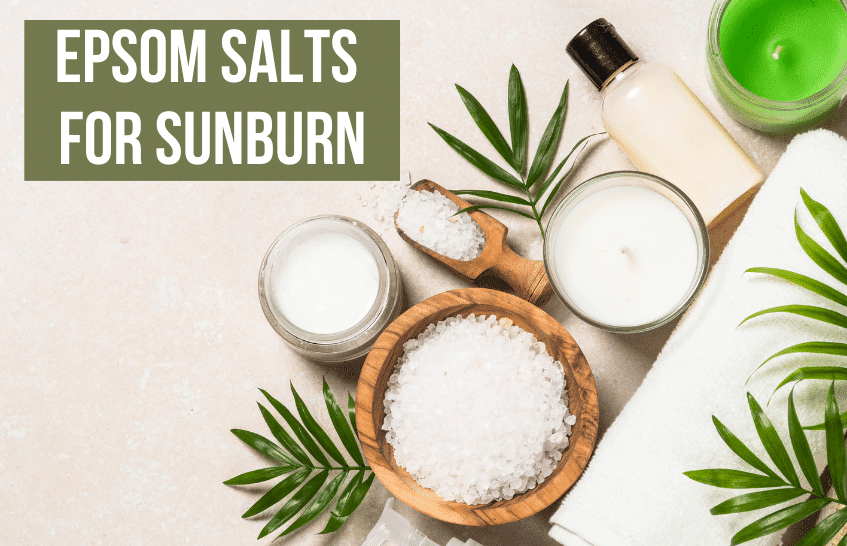 Epsom Salt for Sunburn