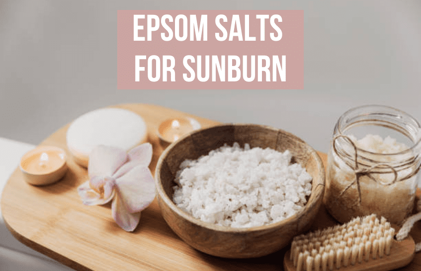 Epsom Salt for Sunburn
